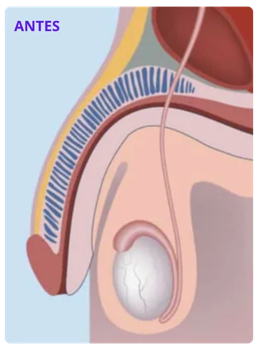 Anatomia do sistema reprodutor masculino antes da vasectomia